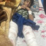 حادثة مؤسفة في متنزه الزوراء: توضيح رسمي بعد إصابة طفل بهجوم نمر